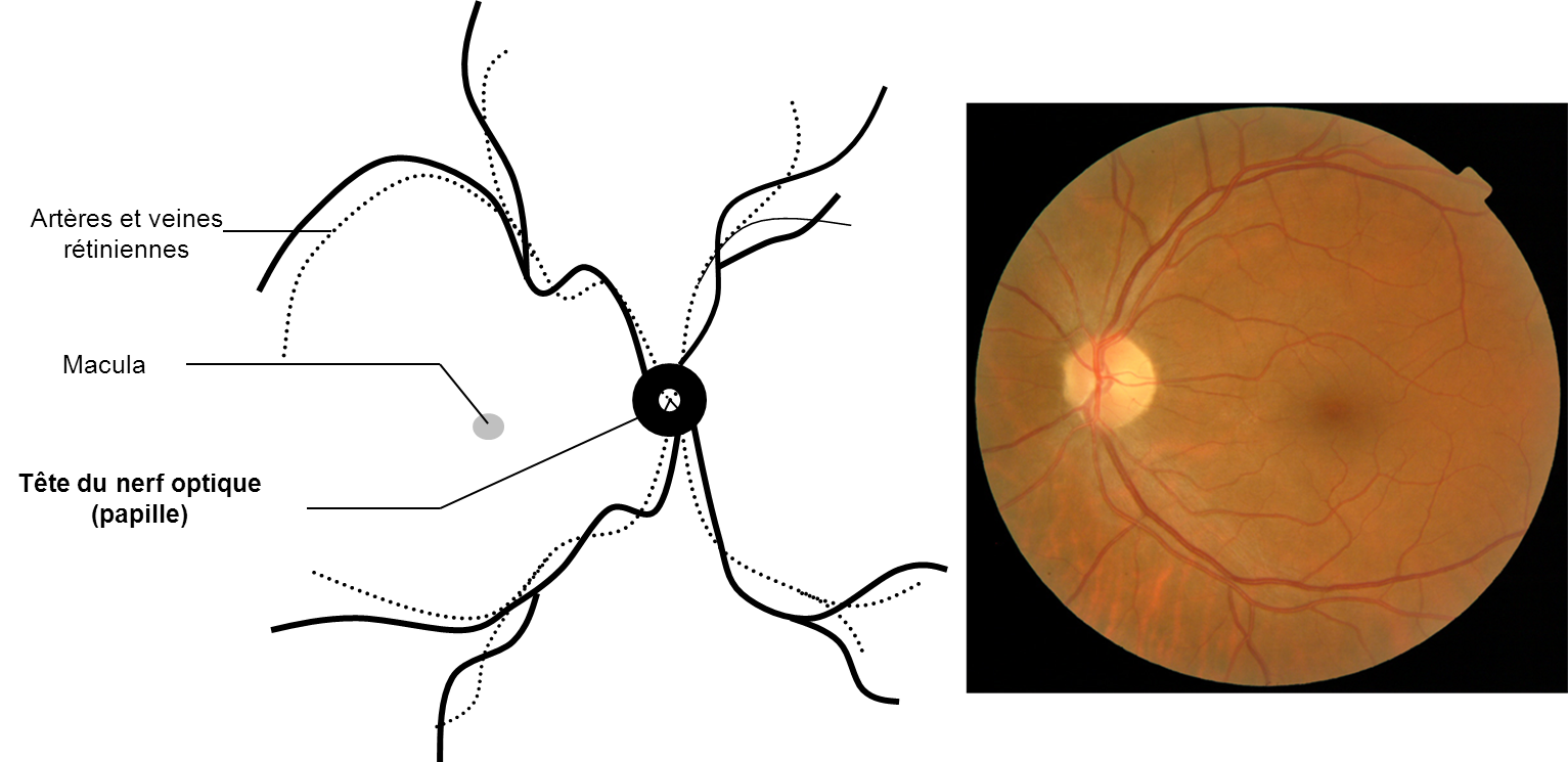 La papille ou tête du nerf optique vue au fond d'oeil